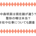 中森明菜は現在顔が違う?整形の噂は本当?年収や仕事についても調査!